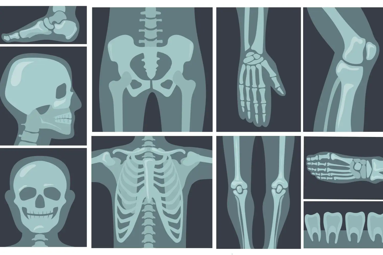 No solo sufren tus huesos: estos órganos vitales también se ven afectados por la osteoporosis